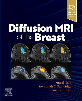 Image for Diffusion MRI of the Breast Diffusion MRI of the Breast