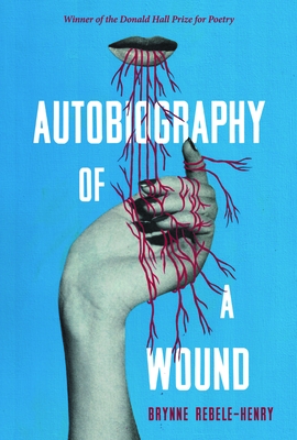 Autobiography of a Wound (Pitt Poetry Series)